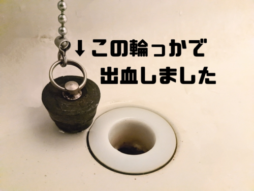 この輪っかで出血しました
